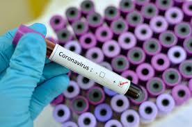 Emergenza Coronavirus: tutti gli aggiornamenti su normativa e ordinanze 